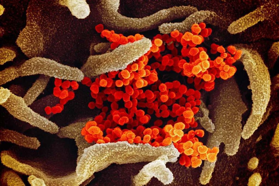 Eine elektronenmikroskopische Aufnahme des U.S. National Institute of Health zeigt das neuartige Coronavirus. (Foto:  (dpa))